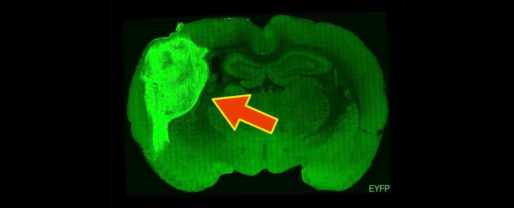 科学家将人类脑组织拼接到小老鼠的大脑中