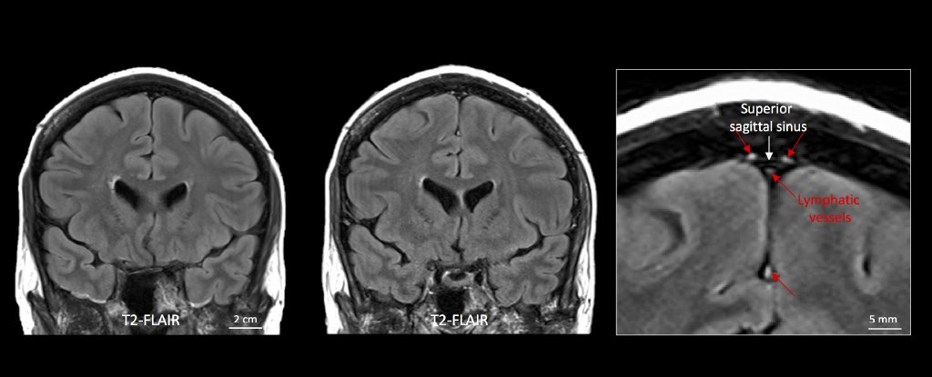 科学家终于发现了我们的大脑有废物排放系统的证据