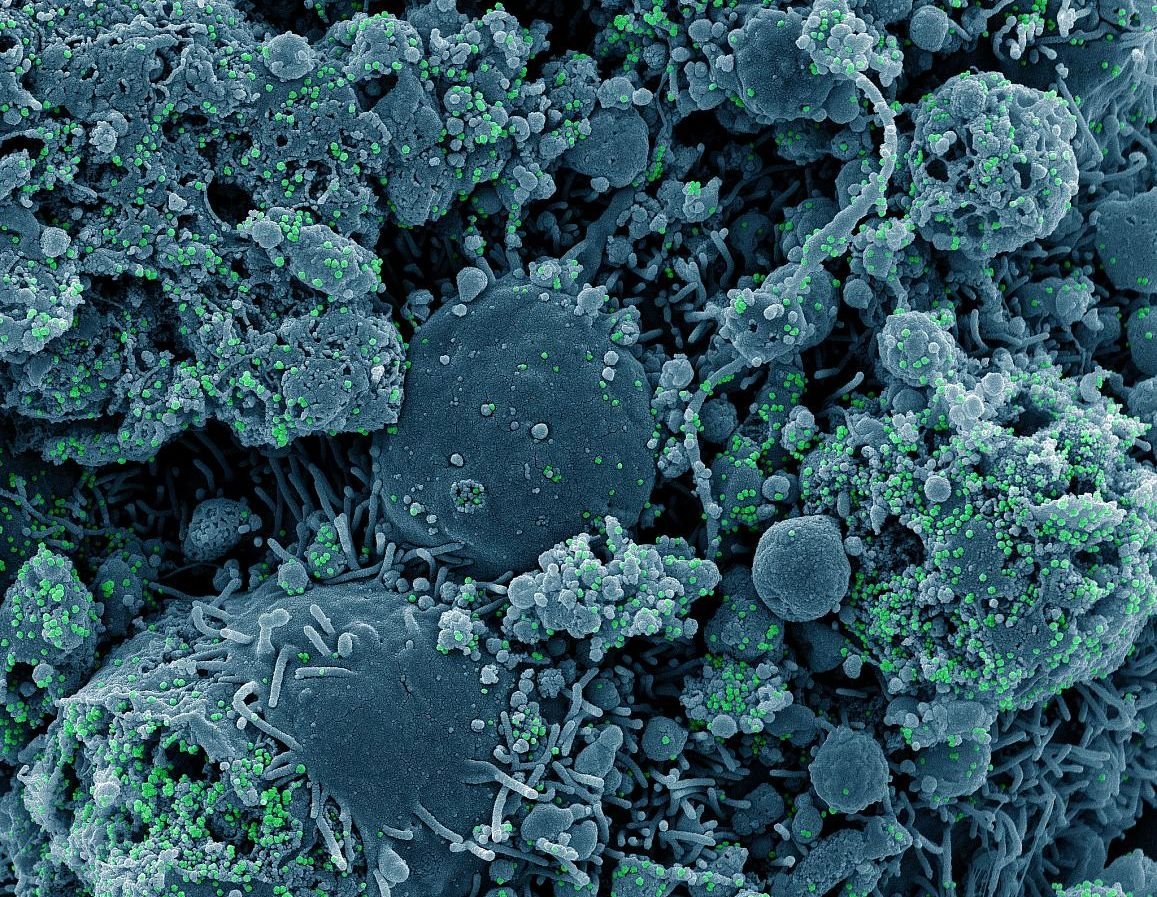 Bioguard：使未來大流行的高級解決方案